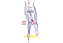 lateral gait
